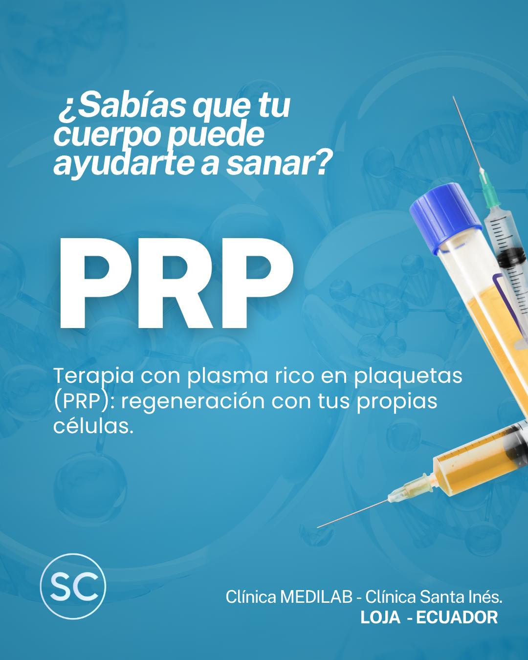 Beneficios del PRP